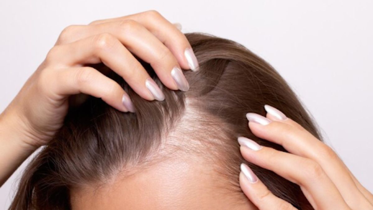 How Female Hair Transplant Melbourne Improves Hair Density