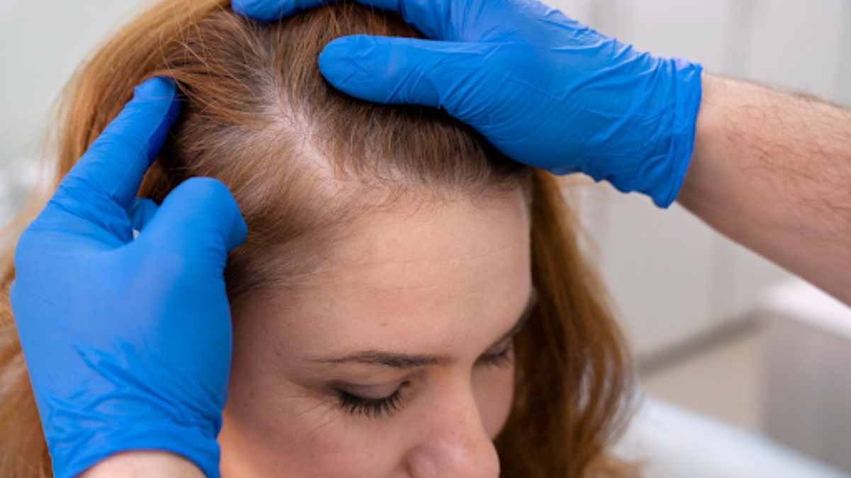 How Female Hair Transplant Melbourne Improves Hair Density
