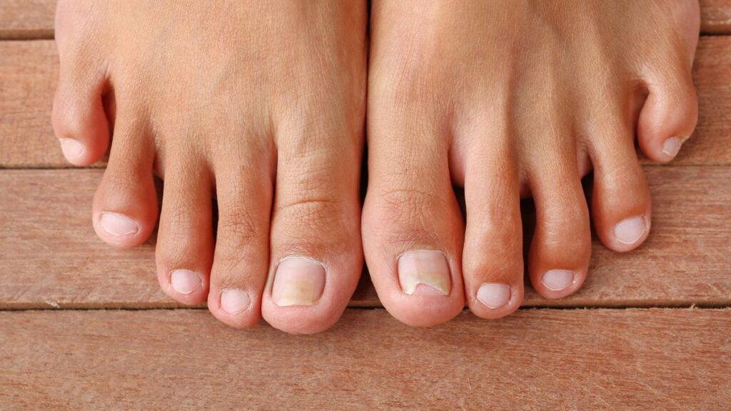 Toenails